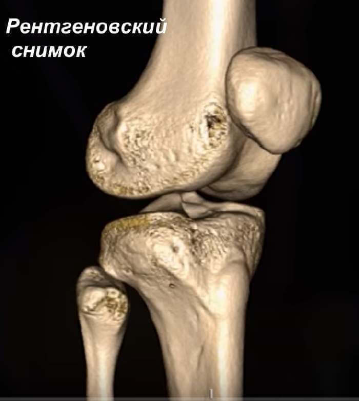 Рентгеновский снимок Рентгеновский снимок